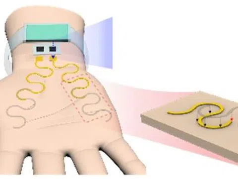 'Hình xăm điện tử' giúp phát hiện căng thẳng