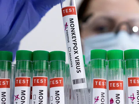 Roche phát triển bộ kit test nhanh virus đậu mùa khỉ