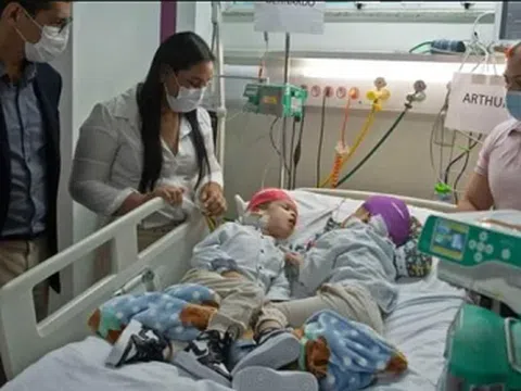 Sử dụng công nghệ VR tách rời cặp song sinh dính liền hộp sọ